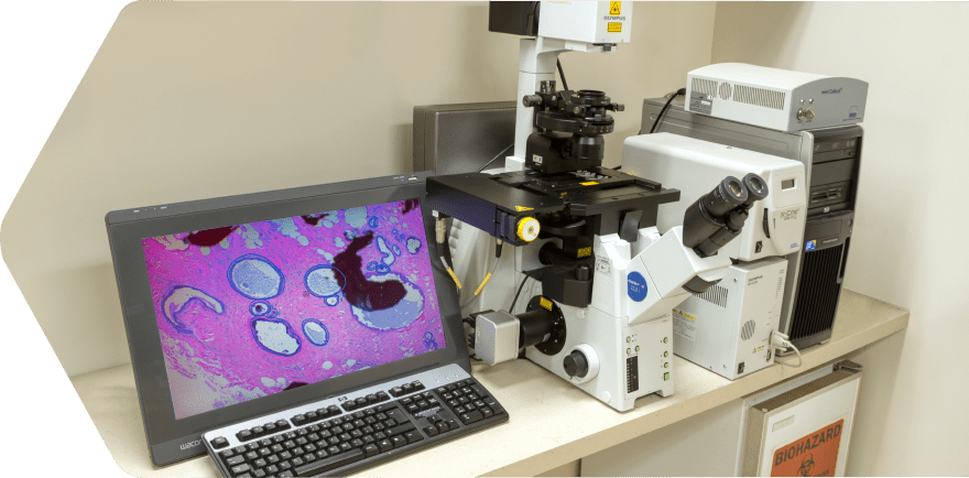 Laser capture microdissecting, LCM system, laser capture microdissection technology services with image analysis